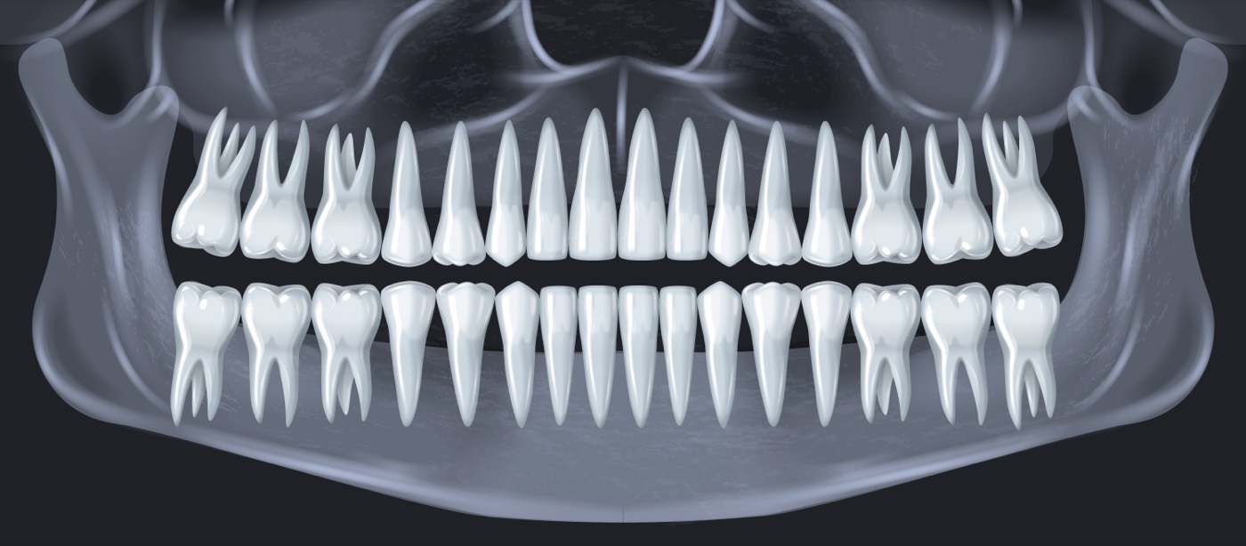 Panoramic X-ray - Elena K.